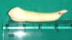 Un Indien de 20 ans s’est vu retirer une dent de 3,9 cm, la dent la plus longue du monde. © IntEngineering, Twitter